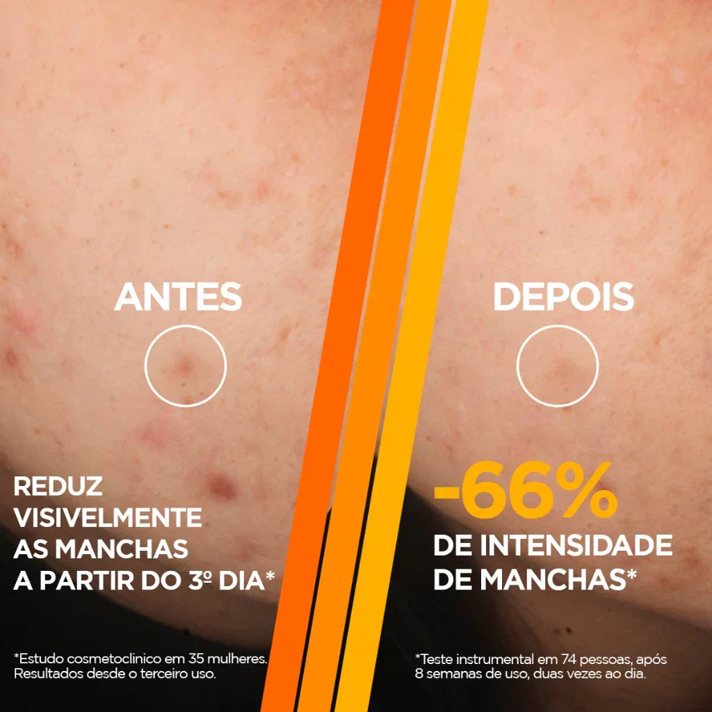 Sérum Facial Antimarcas Garnier Uniform & Matte Vitamina C, 15ml